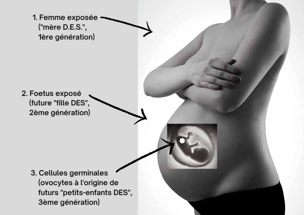 Cellules Germinales Primordiales DES 3 Generations Exposees Lors De La Prise De Medicament Distilbene Reseau DES France